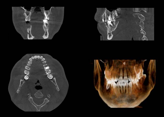 Cone Beam CT Imaging Examples