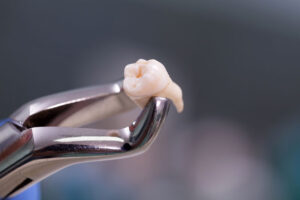 Aesthetic stomatology client watching at process of dental implant installation.
