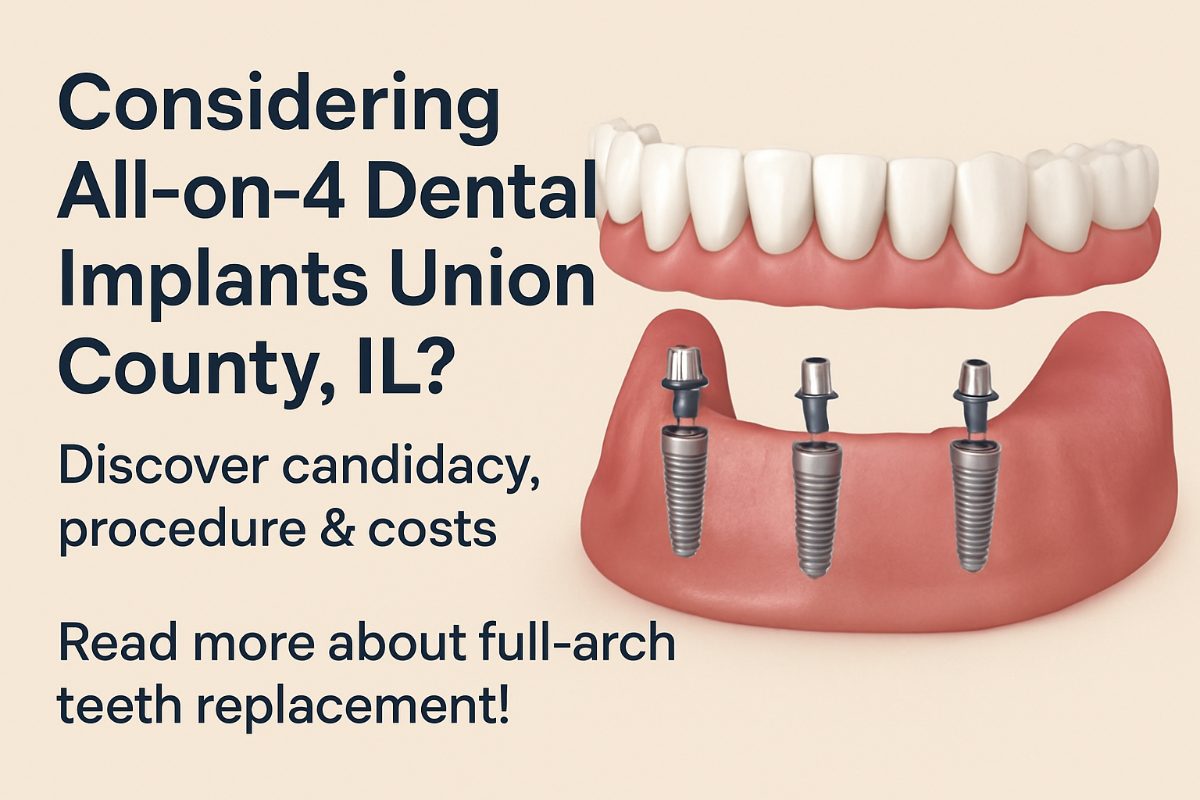 A dentist is consulting with a patient about All-on-4 dental implants while pointing to a digital scan of the patient's jaw. The image conveys a sense of advanced technology and personalized care. No text on image.