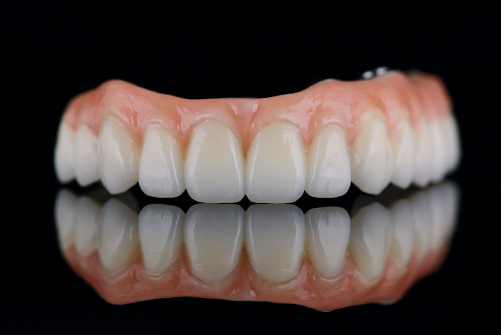 A dentist is reviewing a 3D rendering of a patient's mouth, pointing out the planned placement of a dental implant on a large monitor. The text on the screen says "Dental Implant Treatment Plan".