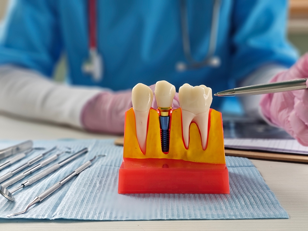 Dentist and dental props working in a dental office, dental props and dentist posing for a photo.