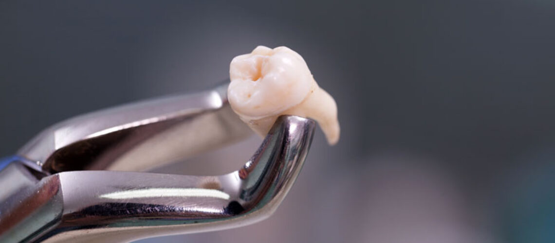 Aesthetic stomatology client watching at process of dental implant installation.