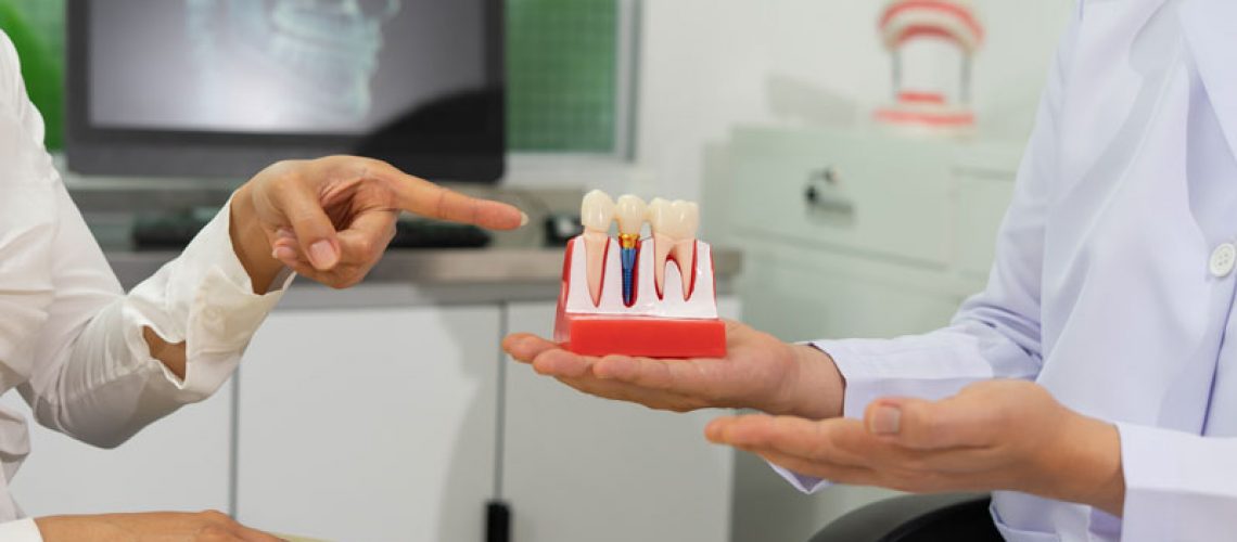 Dentist explains dental implants using model in dental clinic.