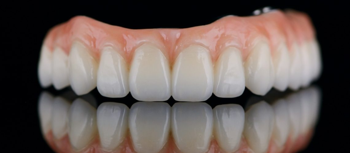 A dentist is reviewing a 3D rendering of a patient's mouth, pointing out the planned placement of a dental implant on a large monitor. The text on the screen says "Dental Implant Treatment Plan".